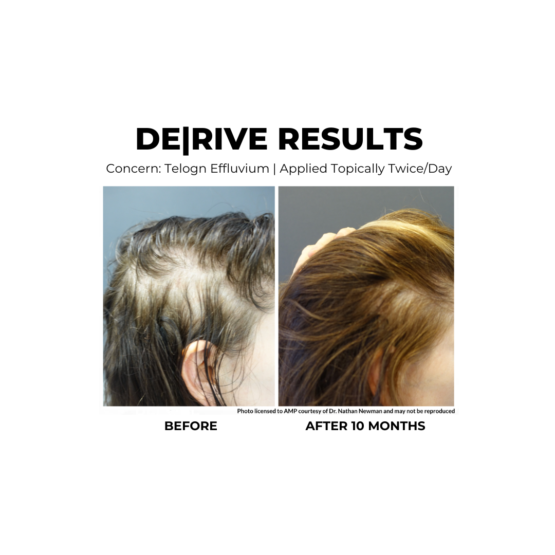 DE|RIVE Hair Support Serum | Syringe & 60ml Bottles